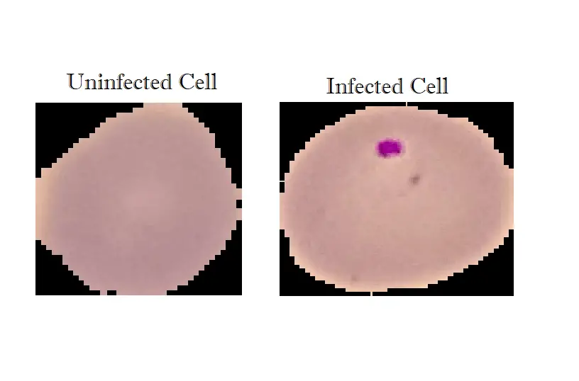 Infected and uninfected cell image
