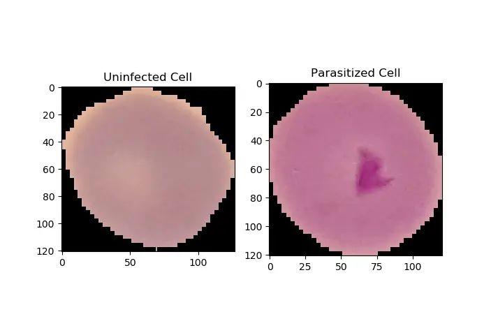 Malaria Infected vs Uninfected Cells
